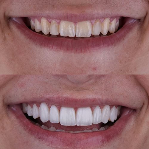 SaveClip.App_473642179_18483274813022740_2892997695517768881_n (1)