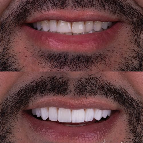 SaveClip.App_481749542_18490567540022740_1908734780877142378_n (1)