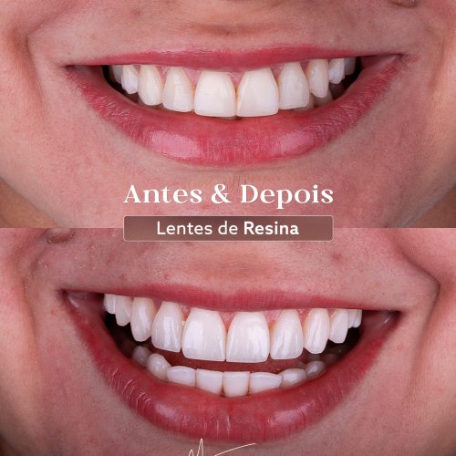 SaveClip.App_490526214_18501108652022740_8576468124626550397_n (1)