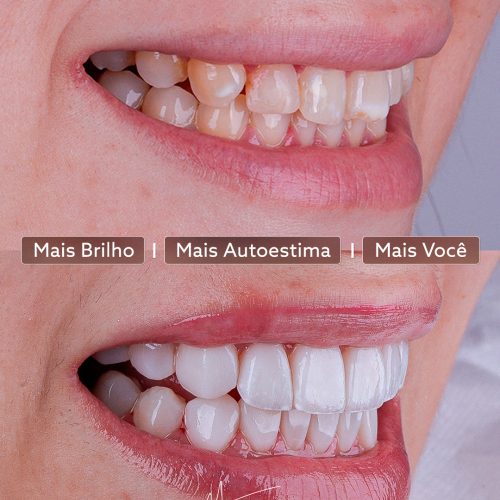 SaveClip.App_500538938_18507085594022740_7344730912991150910_n